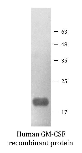 Human GM-CSF recombinant protein