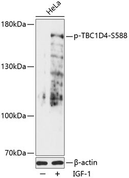 Anti-phospho-TBC1D4 (Ser588)