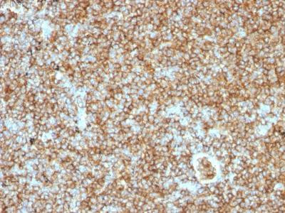Anti-CD45RB (B-Cell Marker)(Clone: PTPRC/1147)
