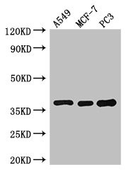 Anti-SLC9A3R2