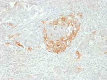 Anti-NSE / Neuron Specific Enolase, clone NSE-P2