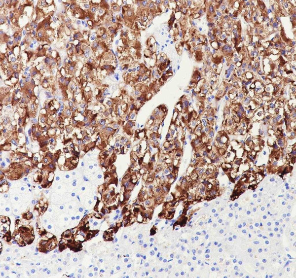 Anti-Recombinant Dopamine beta Hydroxylase, clone A691