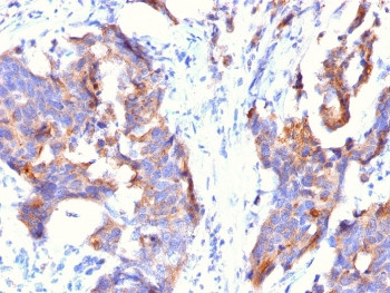 Anti-MUC1 / Mucin-1, clone 115D8