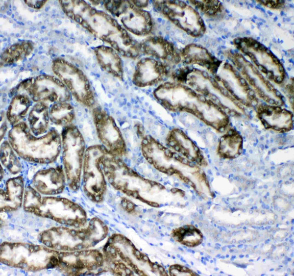 Anti-Glycerol kinase