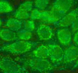 Anti-ALDH6A1