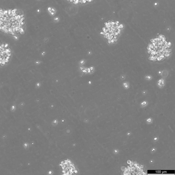 GM12878 Cells