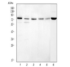 Anti-Caldesmon / CAD