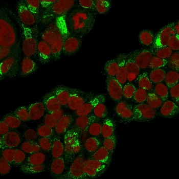 Anti-EBAG9 / Estrogen Receptor Binding Site Associated Antigen 9, clone CPTC-EBAG9-1