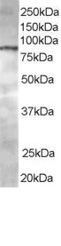 Anti-CENTB1 / ACAP1, C-terminal