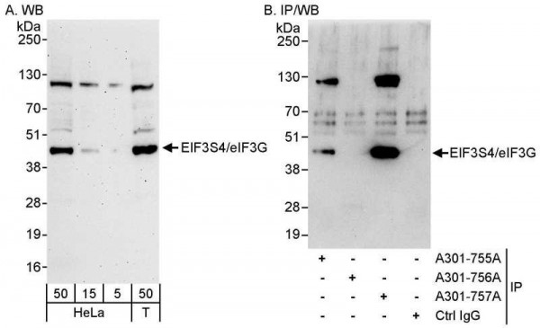 Anti-eIF3G/EIF3S4