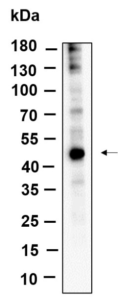 Anti-Recombinant YB-1, clone 9D11