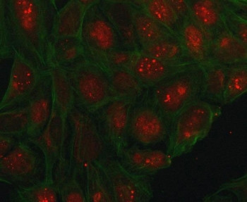 Anti-PHC1 / Polyhomeotic-like protein 1