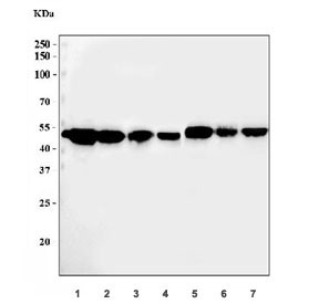 Anti-ADK / Adenosine kinase