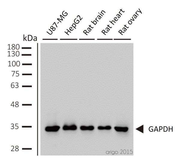 Western Blot Loading Controls Biomol Blog Resources Biomol GmbH
