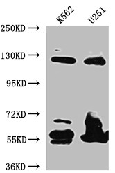 Anti-BUB1B Recombinant Monoclonal, clone 7H4