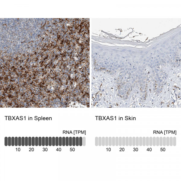 Anti-TBXAS1