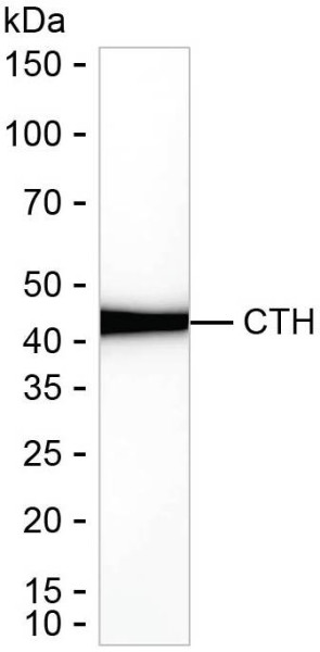 Anti-Cystathionase/CTH