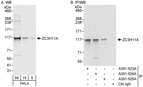 Anti-ZC3H11A