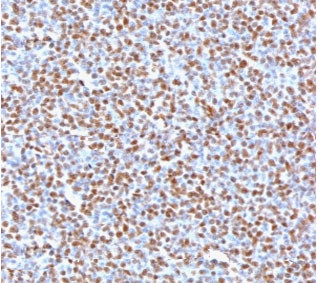 Anti-ALK / Anaplastic Lymphoma Kinase, clone ATKR-2R