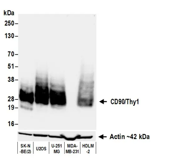 Anti-CD90/Thy1 Recombinant Monoclonal