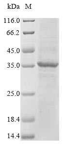 Fc receptor-like protein 6 (FCRL6), partial, human, recombinant