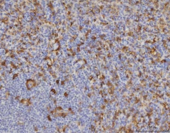 Anti-Malic enzyme 1 / ME1, clone 5E5F7
