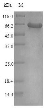 ATP-sensitive inward rectifier potassium channel 10 (KCNJ10), human, recombinant
