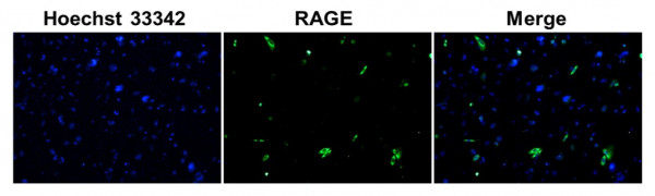 Anti-RAGE, clone SQab1745