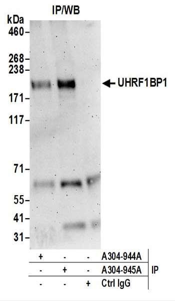 Anti-UHRF1BP1L/KIAA0701