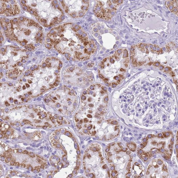 Anti-ACSS3