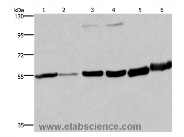 Anti-MCHR1