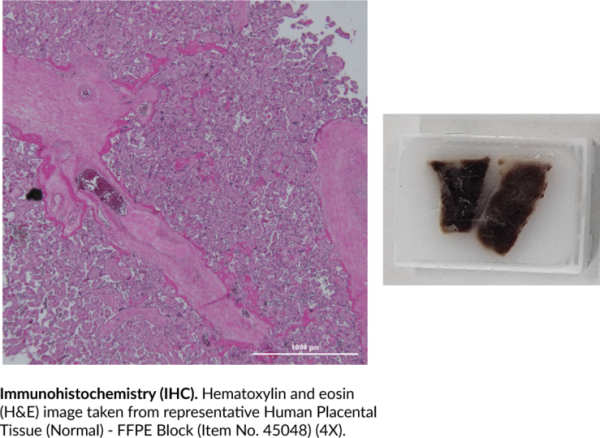 Human Placental Tissue (Normal) - FFPE Block