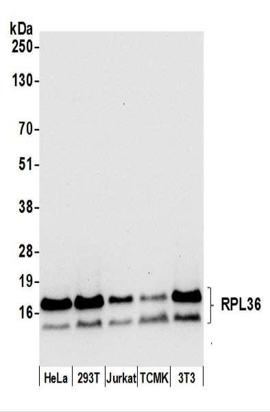 Anti-RPL36/Ribosomal Protein L36