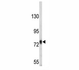 Anti-Amyloid beta Precusor Protein