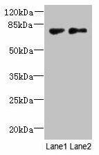 Anti-TTC30B