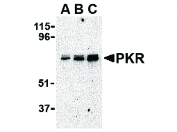 Anti-PKR