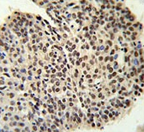 Anti-PRP19 / Pre-mRNA-processing factor 19 / PRPF19