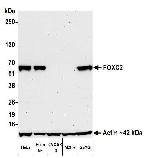 Anti-FOXC2 Recombinant Monoclonal