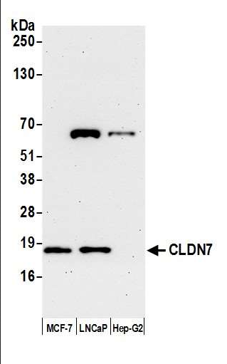 Anti-CLDN7