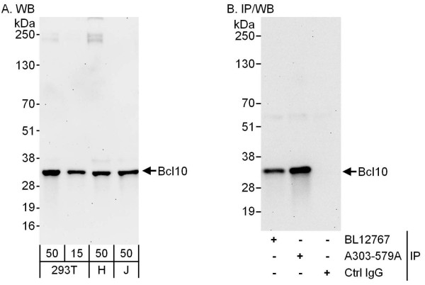 Anti-Bcl10