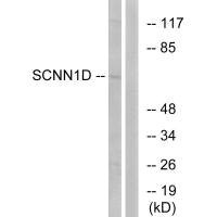 Anti-SCNN1D