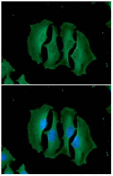 Anti-UNG, clone k1C12