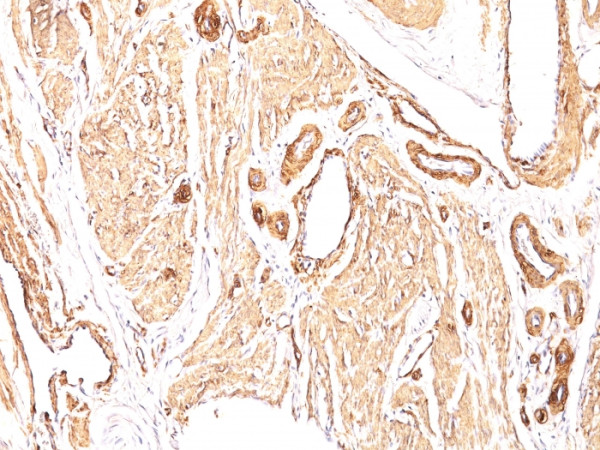 Anti-Actin, Smooth Muscle (Leiomyosarcoma Marker), clone 1A4, same as asm-1