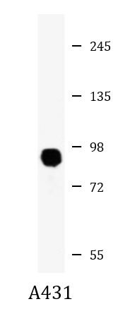 Anti-Desmocollin 3
