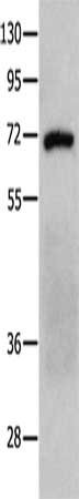Anti-PTPN11