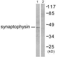 Anti-SYP