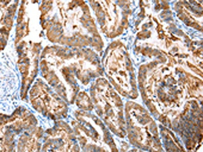 Anti-CXCR4