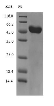 Vitamin D-binding protein (Gc), mouse, recombinant