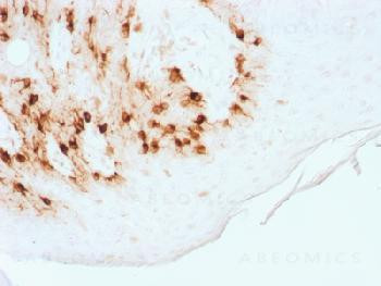 Anti-MART-1 / Melan-A / MLANA (Melanoma Marker) (clone: MLANA/1761R) (recombinant rabbit monoclonal)