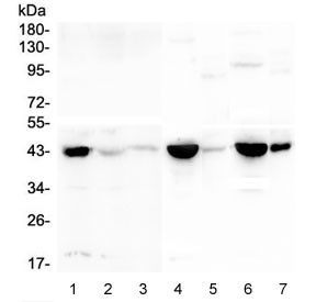 Anti-CKM / Creatine Kinase M